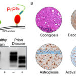 Dis Ease Meaning: Unveiling the Hidden Impact
